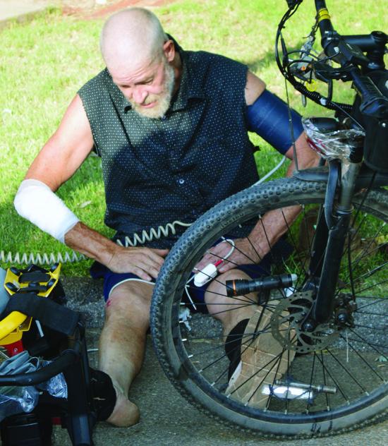 Jeff Keeton recovers after he said three local dogs ran up to him on his bike and tried to bite him Friday morning at N. 14th and Prairie Chief Avenue. He said he was fine with no broken bones, and only a road rash to his arm and knee. CDN | Christian Jac